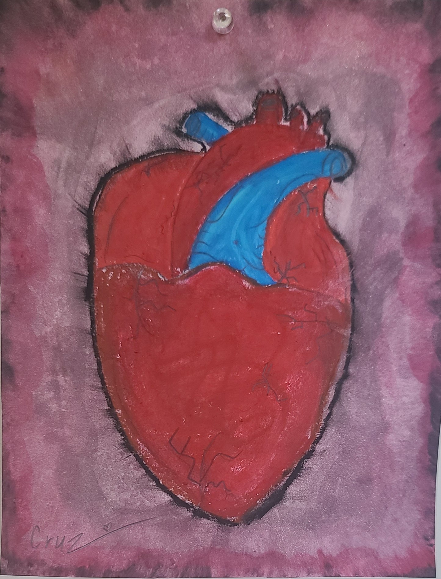 Rich Pastel Exposed Human Heart